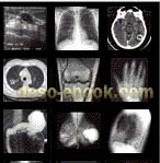 Radiology